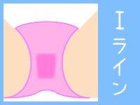 Iライン